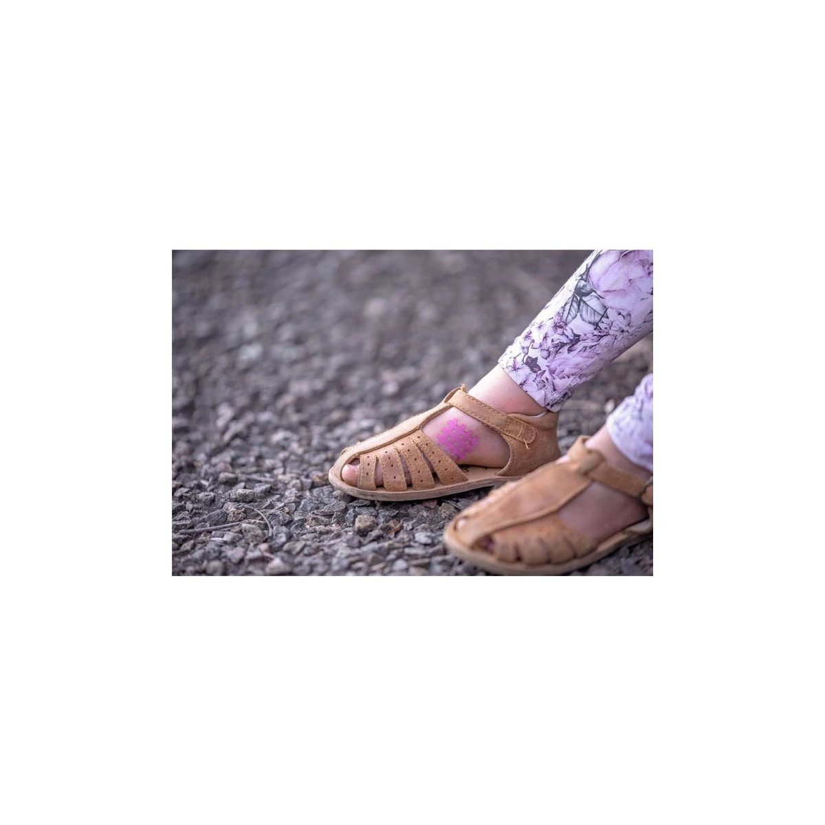 Itch Relief Patches